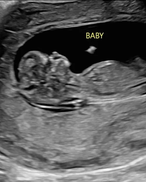 Der kommende Nachwuchs bei Becky Lynch und Seth Rollins - Quelle: instagram.com/beckylynchwwe