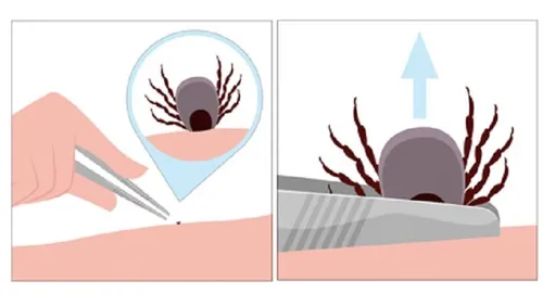 150416 infographic rivm weghalen teek e1429641374604