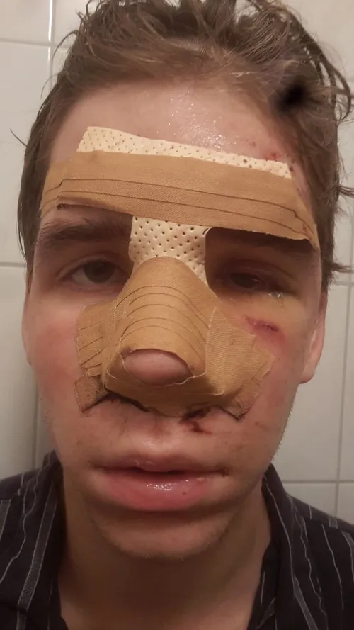 mishandeling jongen tilburg