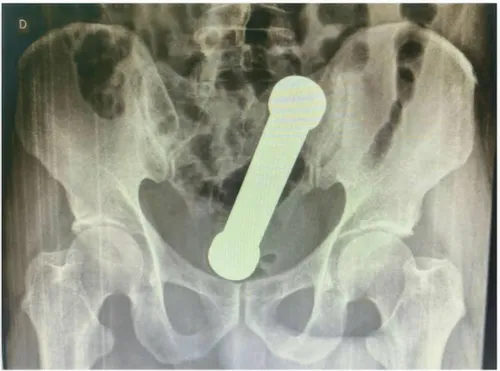 picture_vk_dumbell_brasil_01