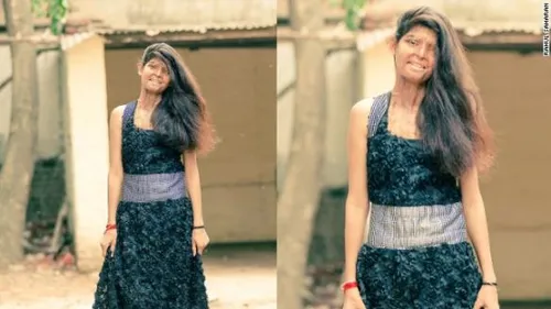 140820114653 india acid model 1 horizontal gallery 584x328