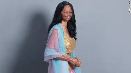 140820114742 india acid model 11 horizontal gallery 584x328