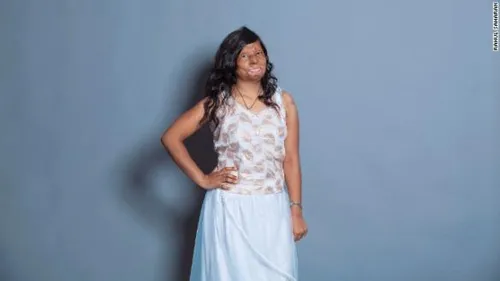 140820114851 india acid model 15 horizontal gallery 584x328