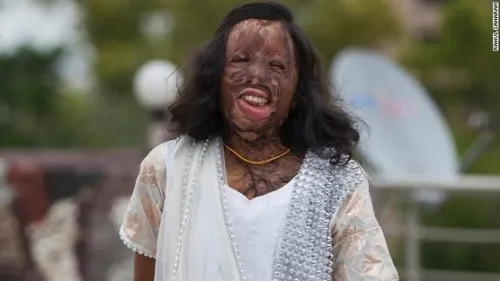 140820115206 india acid model 5 horizontal gallery 584x328