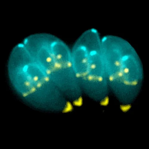 600px toxoplasma gondii