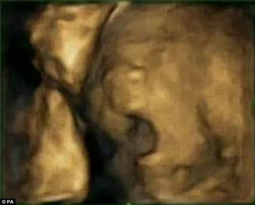 article 2236402 1625334a000005dc 83 634x510