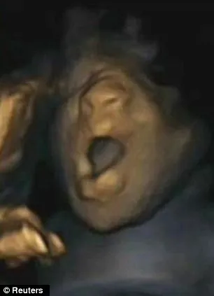 article 2236402 16268569000005dc 99 306x423