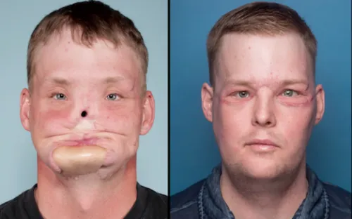 schermafbeelding 2017 11 10 om 135532 584x364