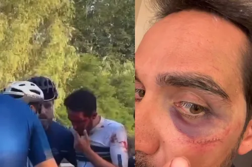 Contador was flink gehavend na een crash in China