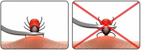 Bron: Tekenbeetziekten.nl