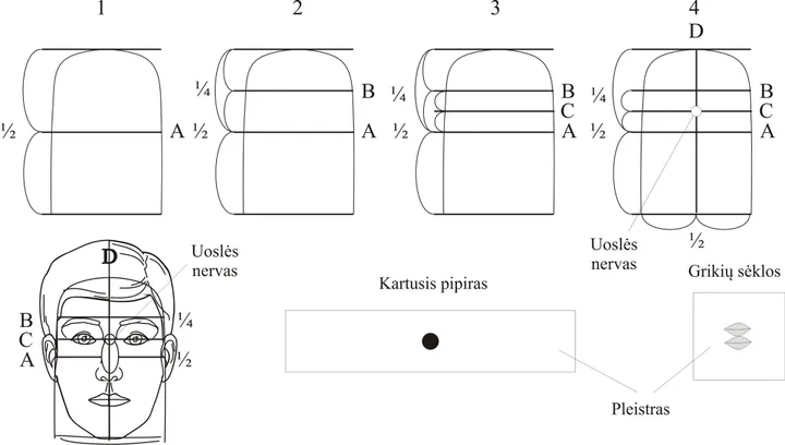 su dzok terapija uosles nervo taskai