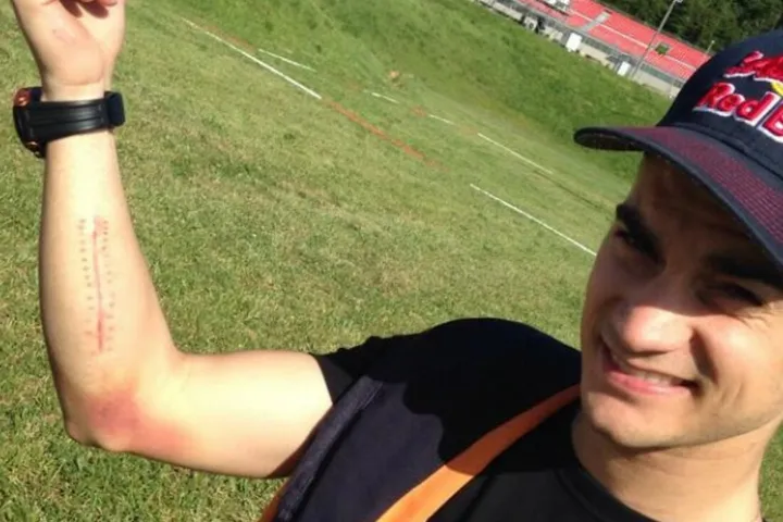 pedrosa arm pump