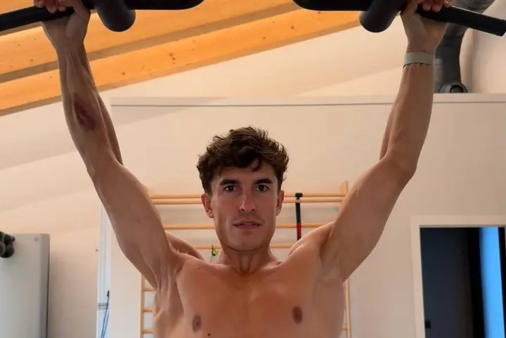 Marc Marquez right arm