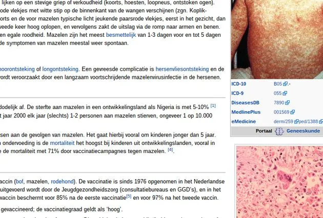 studiepunten-voor-het-verbeteren-van-pag.jpg
