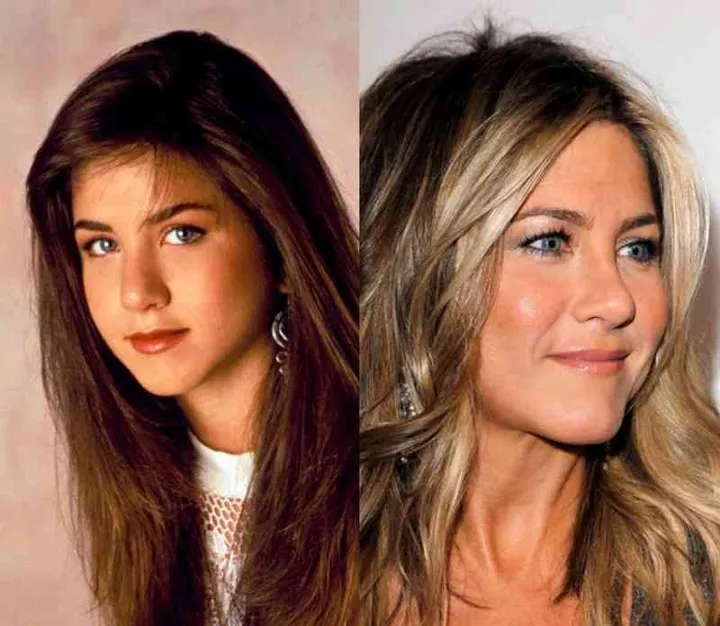 20 celebs who make us want to get plastic surgery 3