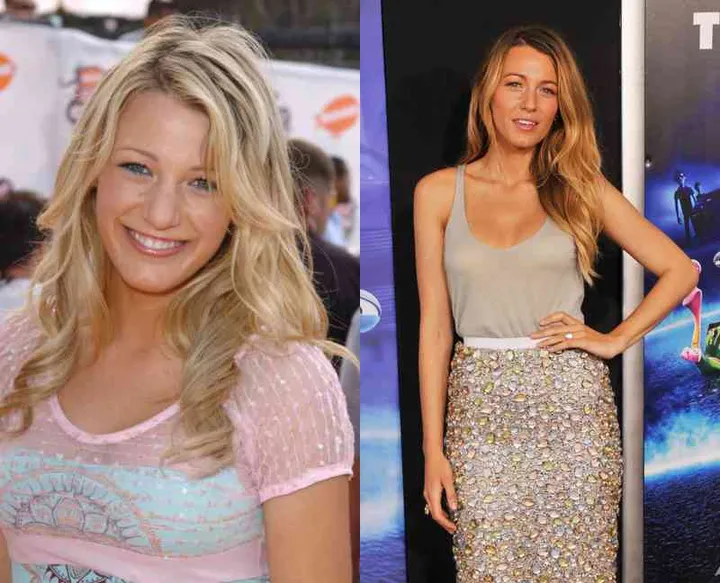 20 celebs who make us want to get plastic surgery 4