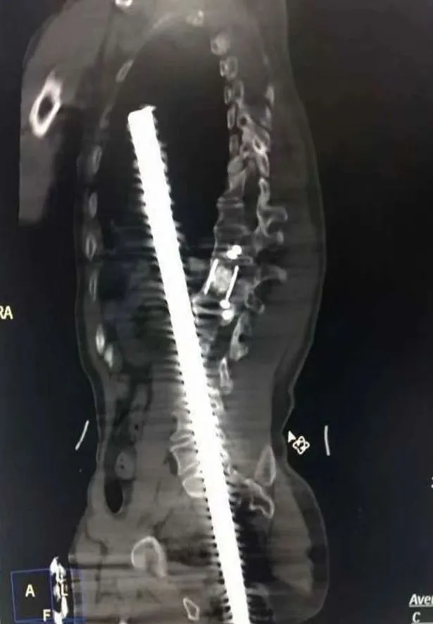 c54cdc785a78de2df00f8e42733e5bdb