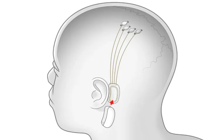 brain computer interface