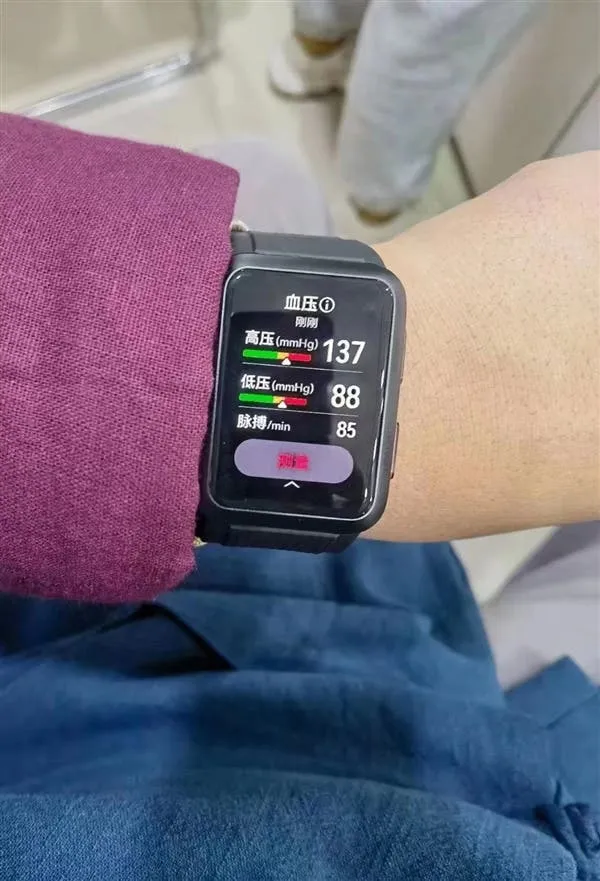 huawei watch d b