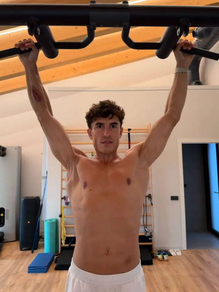 marc-marquez-arm-foto-blessure-schouder