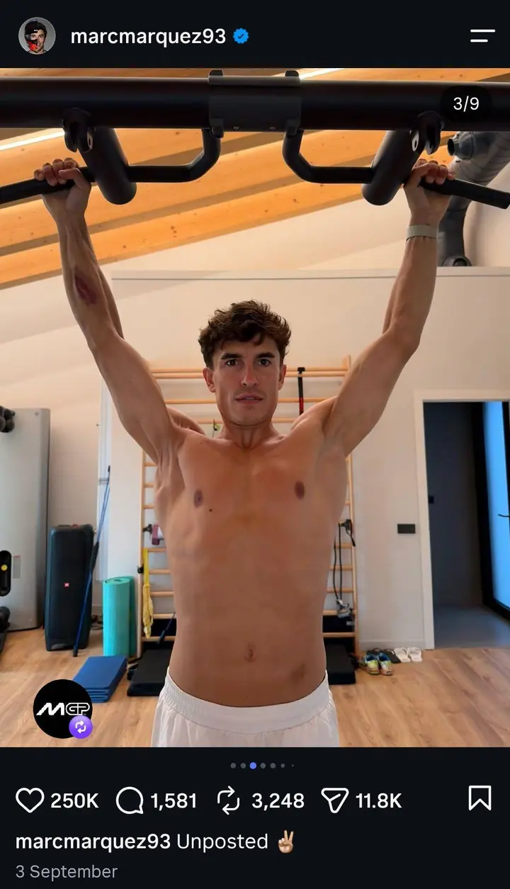 Marquez's right shoulder stunned his followers (Credit: @marcmarquez93)