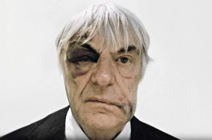This is a handout image from Swiss watchmaker Hublot made available on Tuesday Dec. 7, 2010, showing Formula One Boss Bernie Ecclestone sporting a black-eye for an upcoming ad campaign for the watch maker. Ecclestone was recently mugged in London where 4 men punched and kicked him to the ground and was robbed of his jewellery. Ecclestone, however, has turned the incident to his advantage as shock adverts are due to appear this week for watchmaker Hublot. (AP Photo/Hublot, Ho) EDITORIAL; USE ONLY