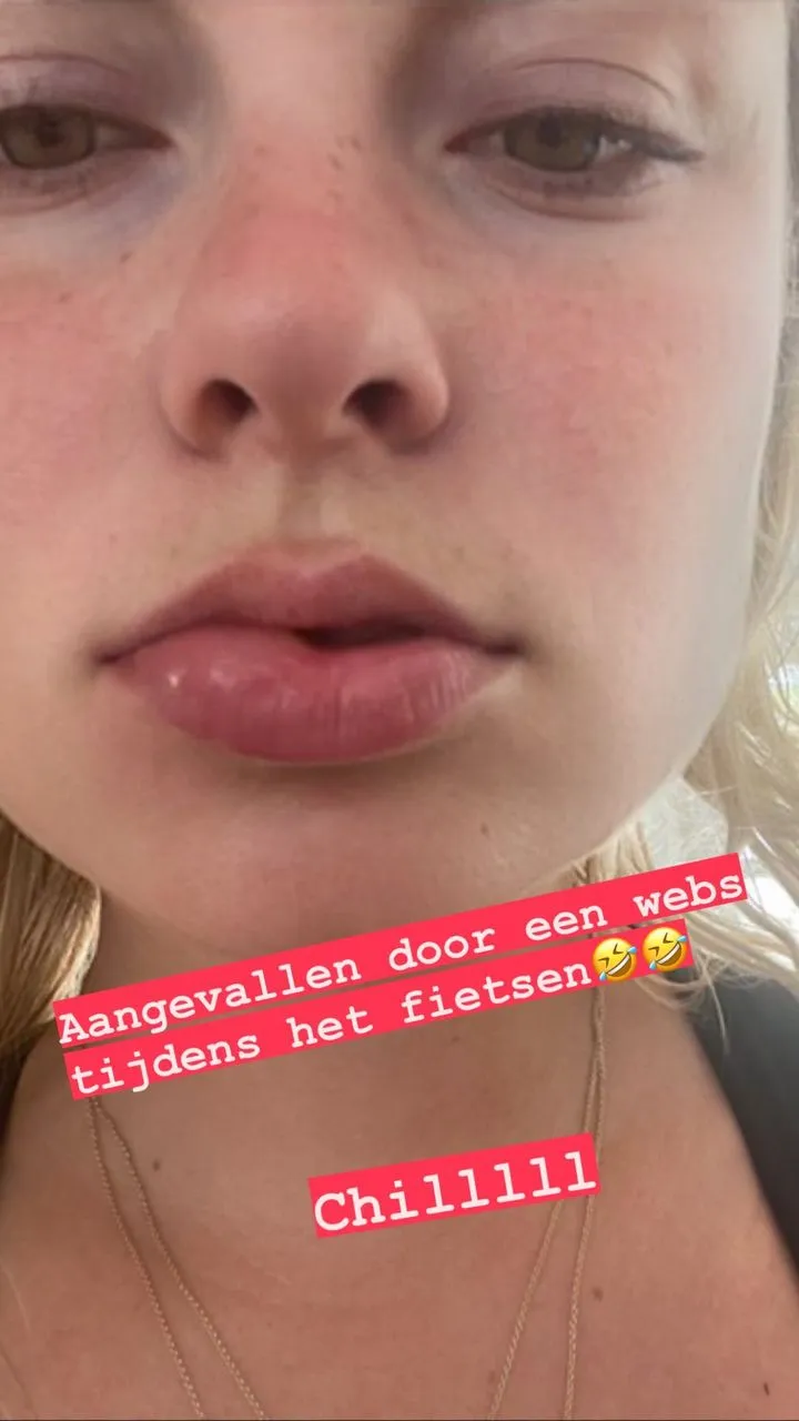 sylvana 3135817067915136017