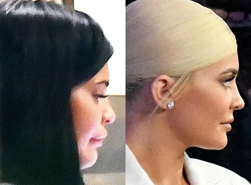 kylie jenner lippen