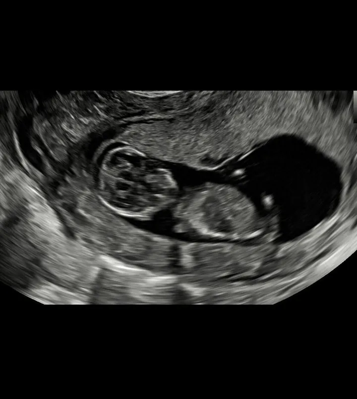 lieke martens zwanger benjamin van leer foto