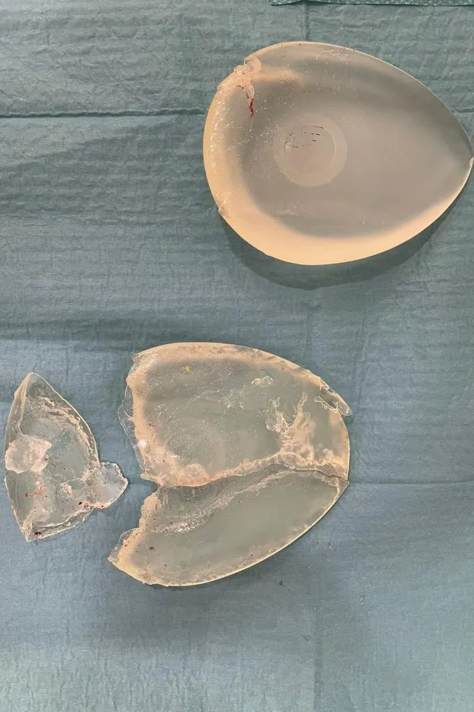 implant