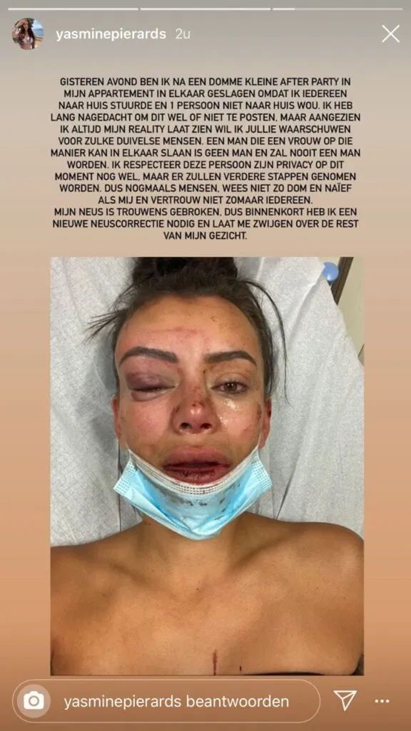 photo 2020 08 11 101519 576x1024