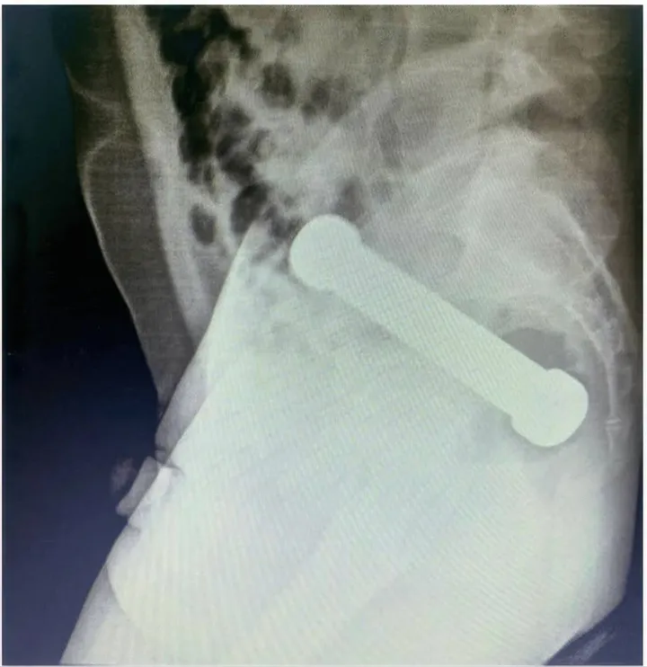 picture_vk_dumbell_brasil_02