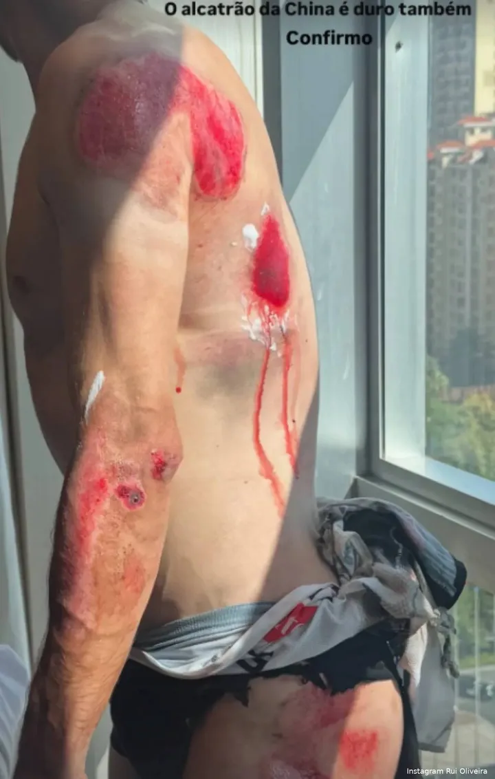 rui-oliveira-68ee746d6ad4a